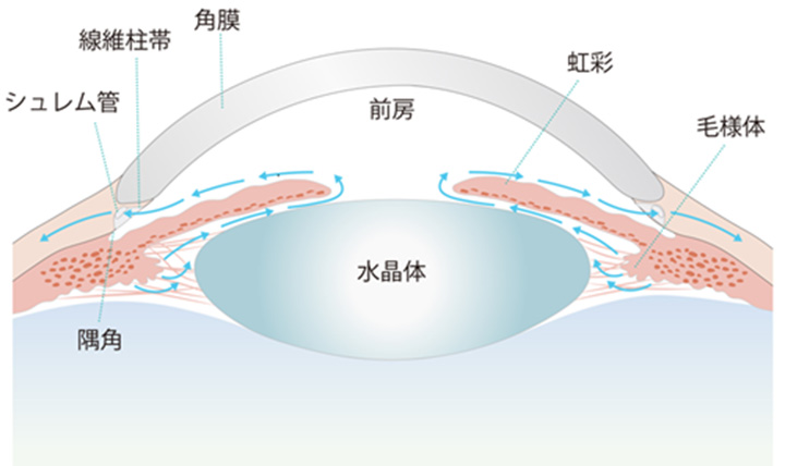 緑内障の原因