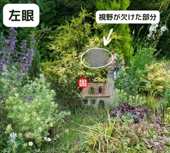緑内障について01